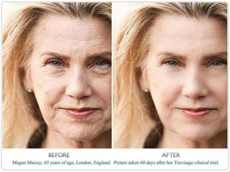 RETINOIDS - Chìa khóa vàng trong từ điển làm đẹp